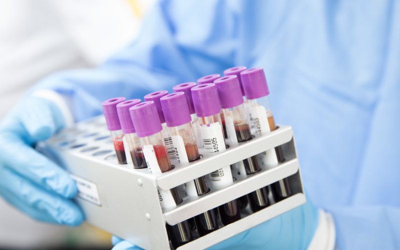 genes stock-25