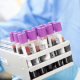 genes stock-25